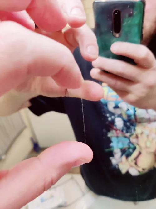 This eye booger I pulled. The relief was amazing