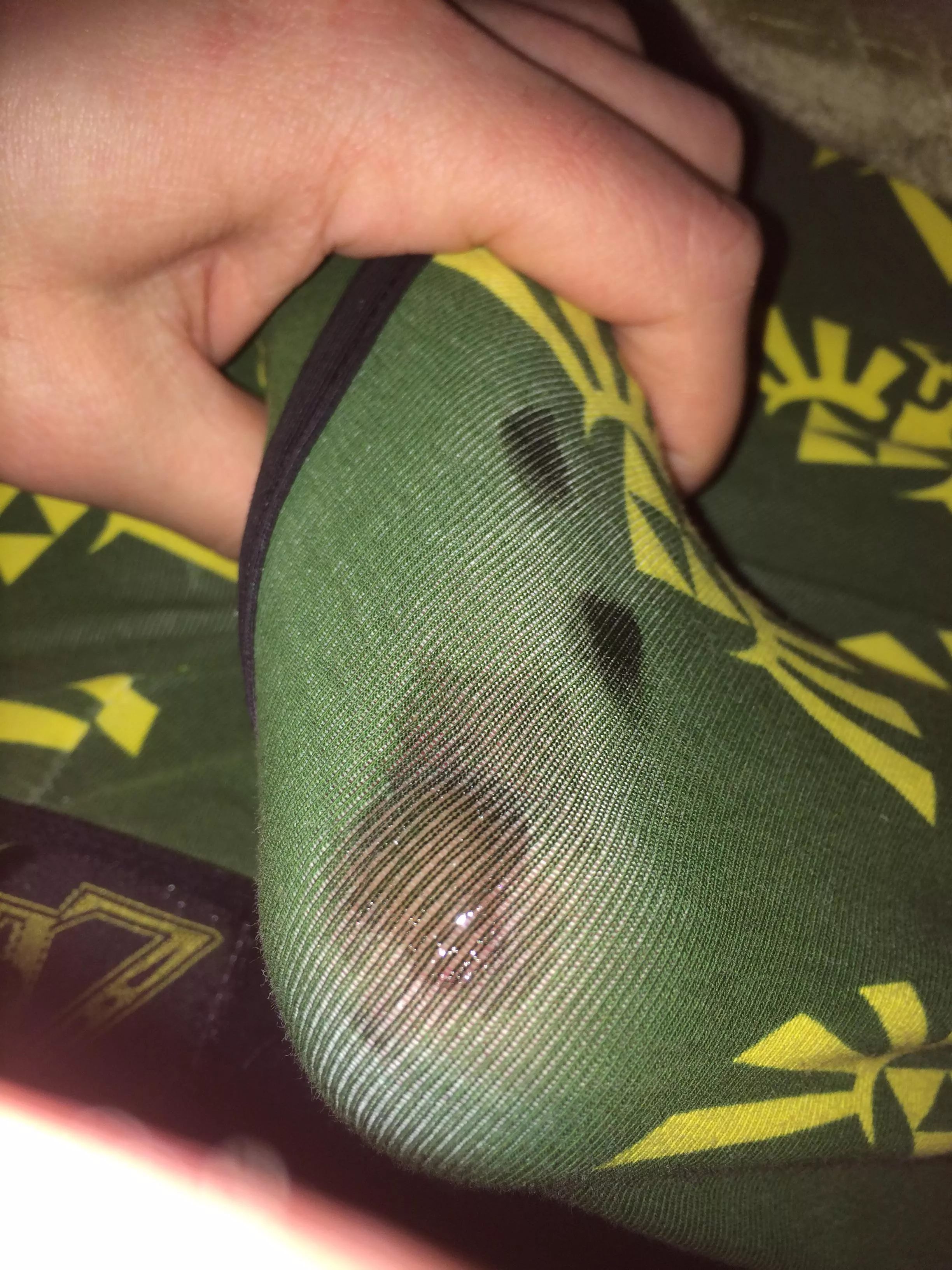 This happens if I wear the same underwear for too long