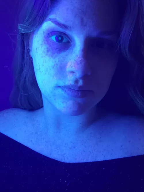 This is what I was talking about with the black light and freckles.. scary but pretty neat 😆