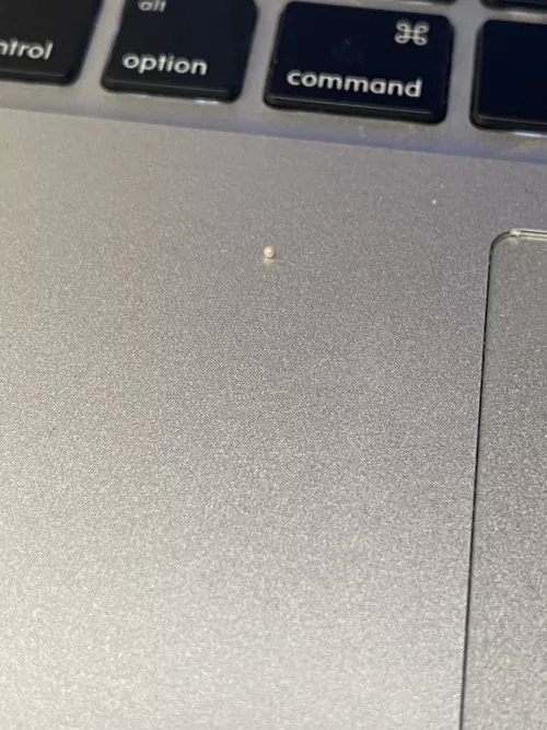 This perfect pearly milia I just dislodged from my ear canal