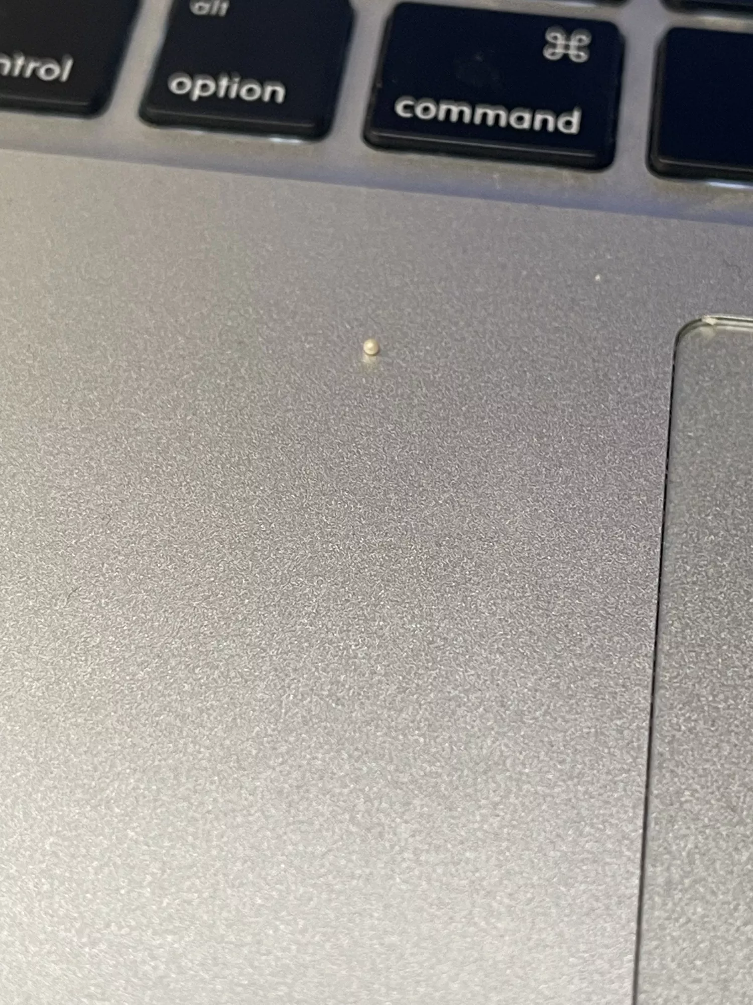 This perfect pearly milia I just dislodged from my ear canal