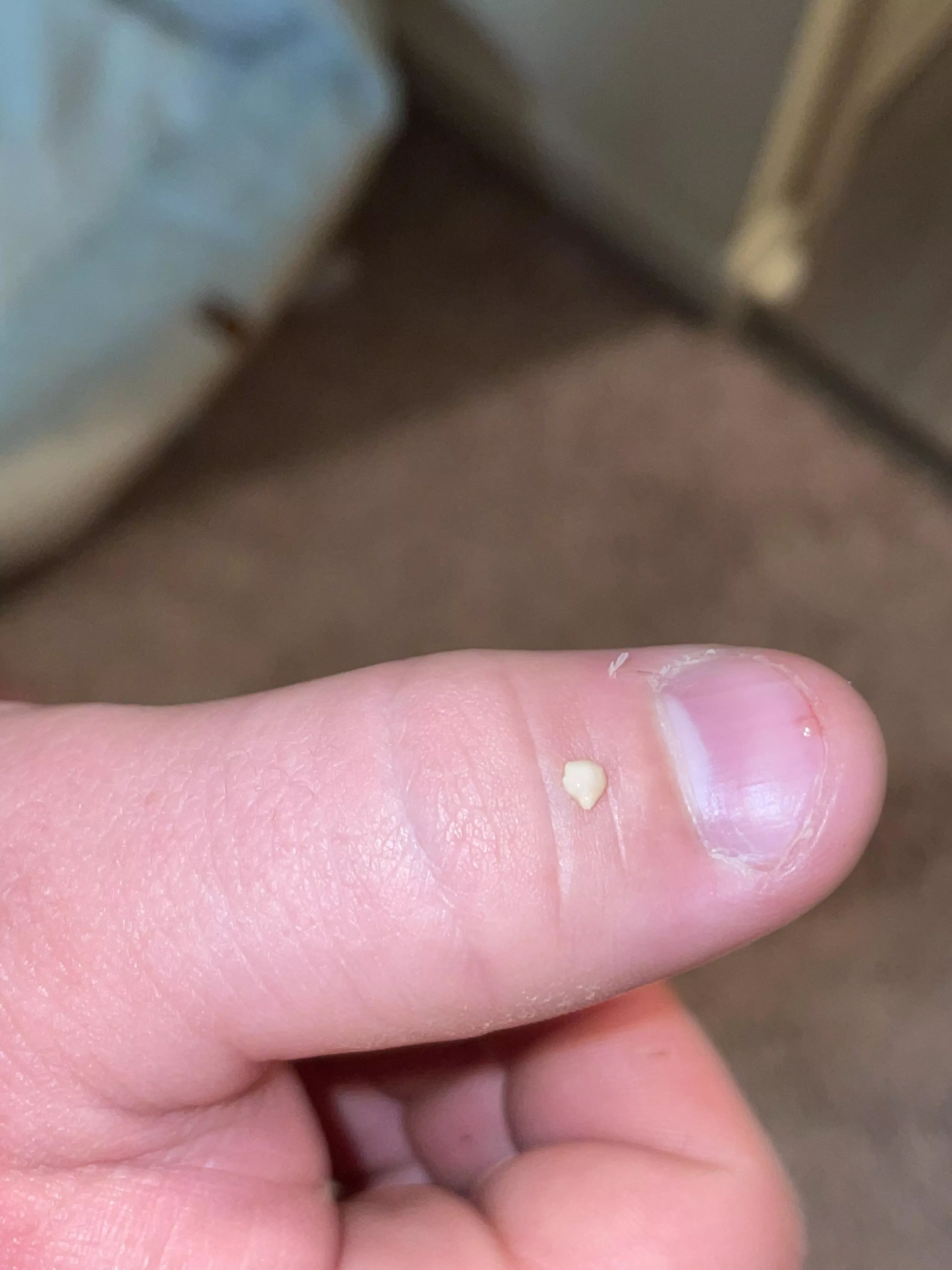 This thing came out from behind my ear and there’s still more of it inside