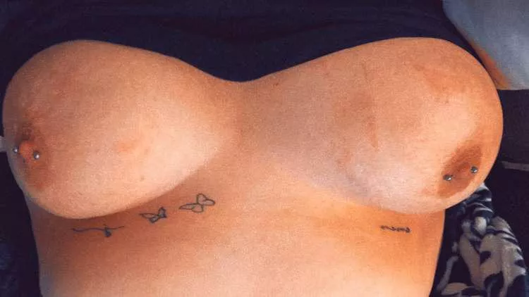 Throwback to when I first got them done [OC]