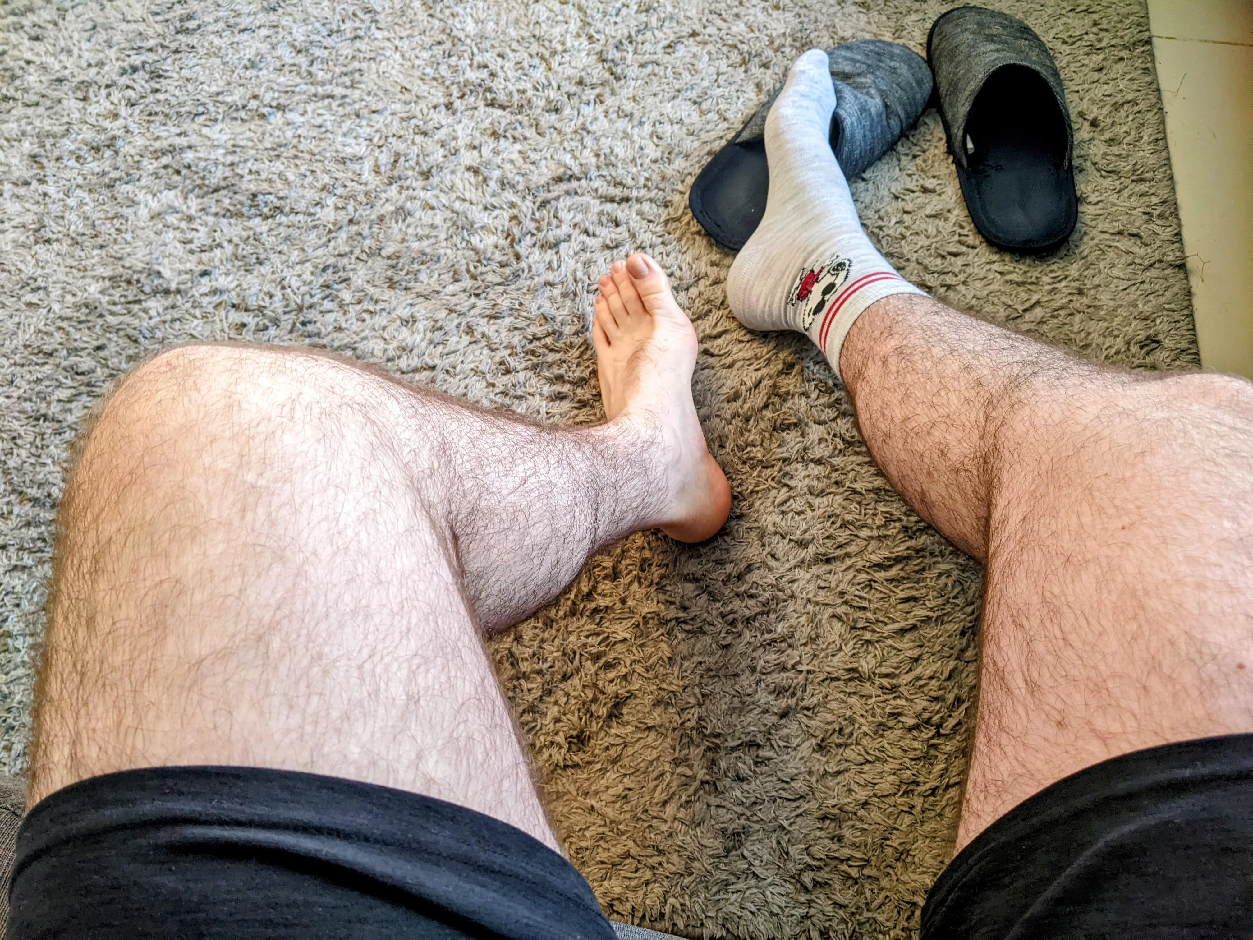 Tired of pants , back to wearing shorts again Tired of pants , back to wearing shorts again