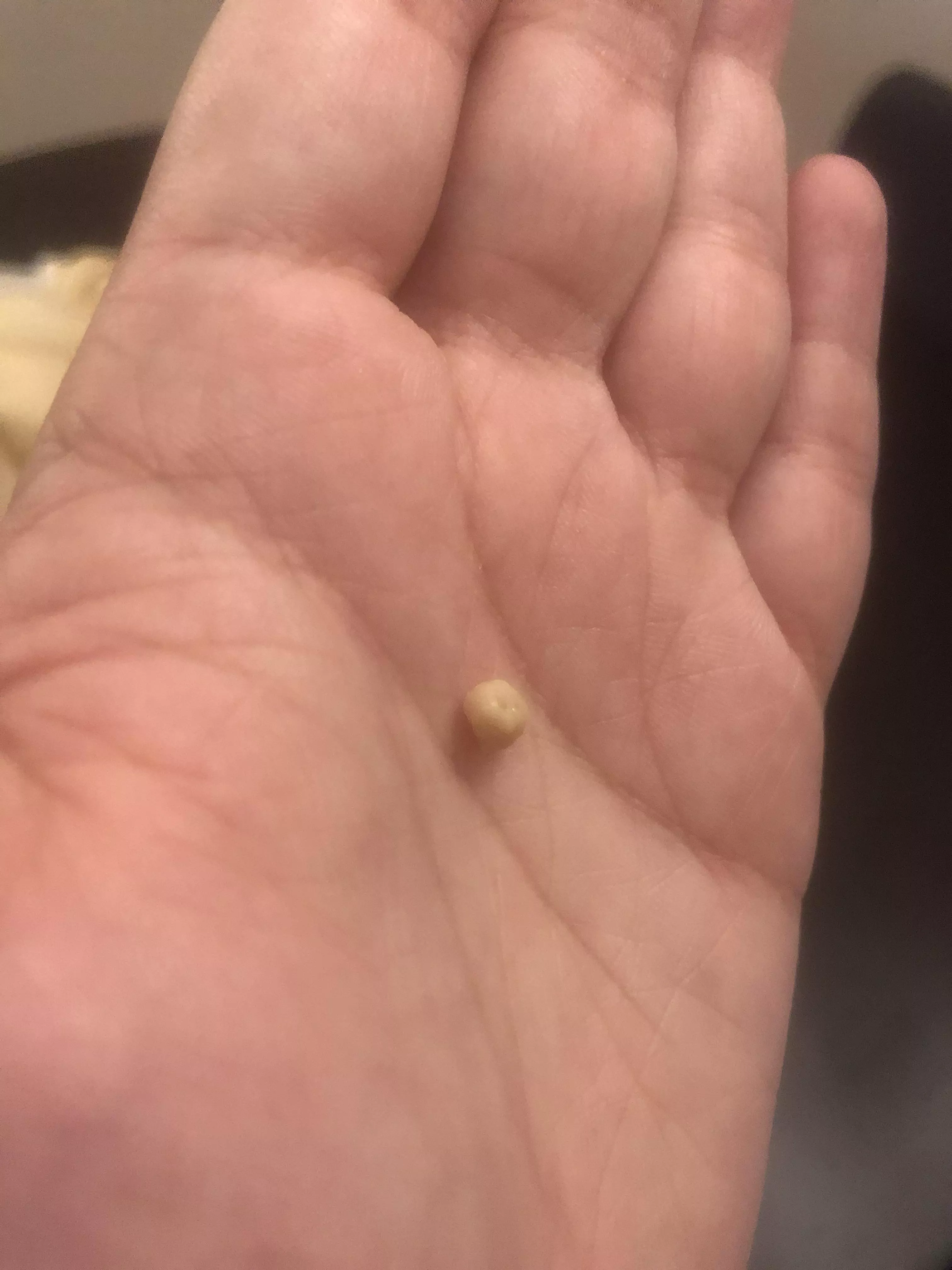 Toddler stuck his hand in my mouth and dislodged this guy 🤷🏻‍♀️