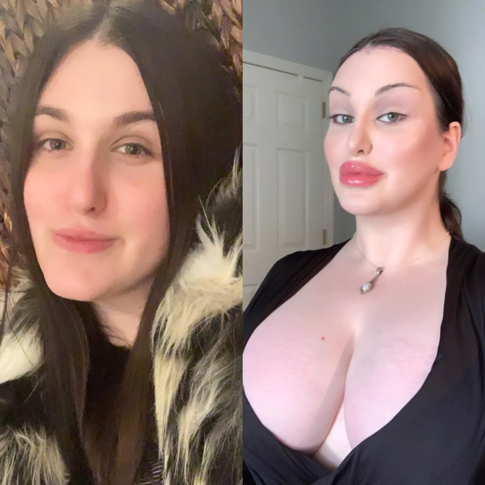 Trans Bmibo of The Year: 2020-2021 (Next Step 2,500cc+ Breast Expanders!) Trans Bmibo of The Year: 2020-2021 (Next Step 2,500cc+ Breast Expanders!)