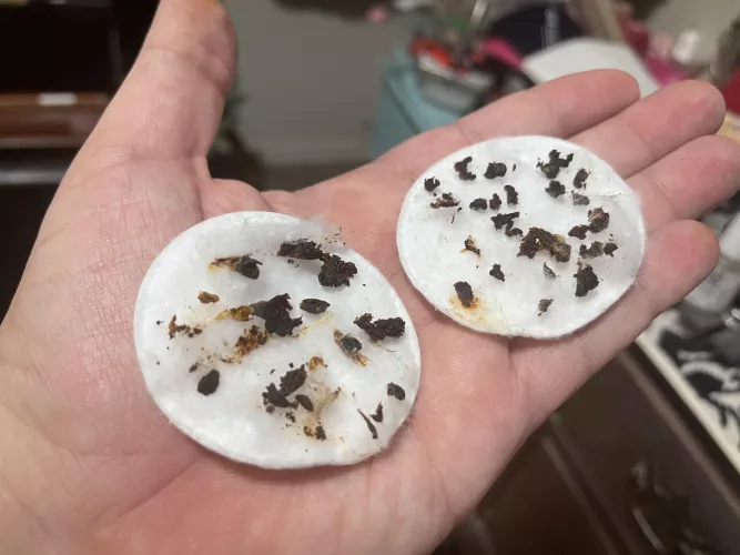 Used a camera assisted earwax tool for the first time ever. Now I can hear colors and smells.