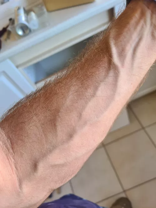 Vascular