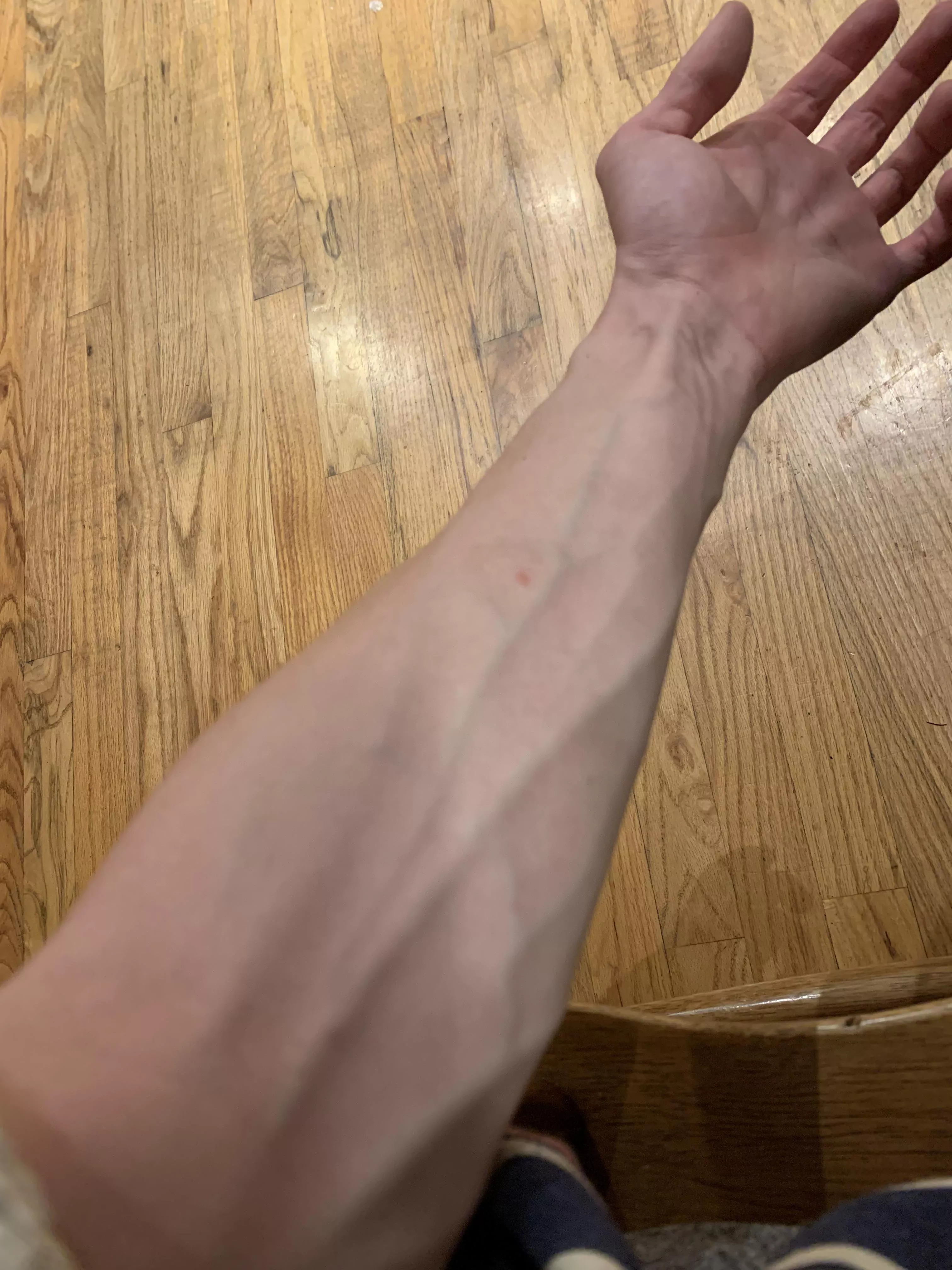 Veins for days…