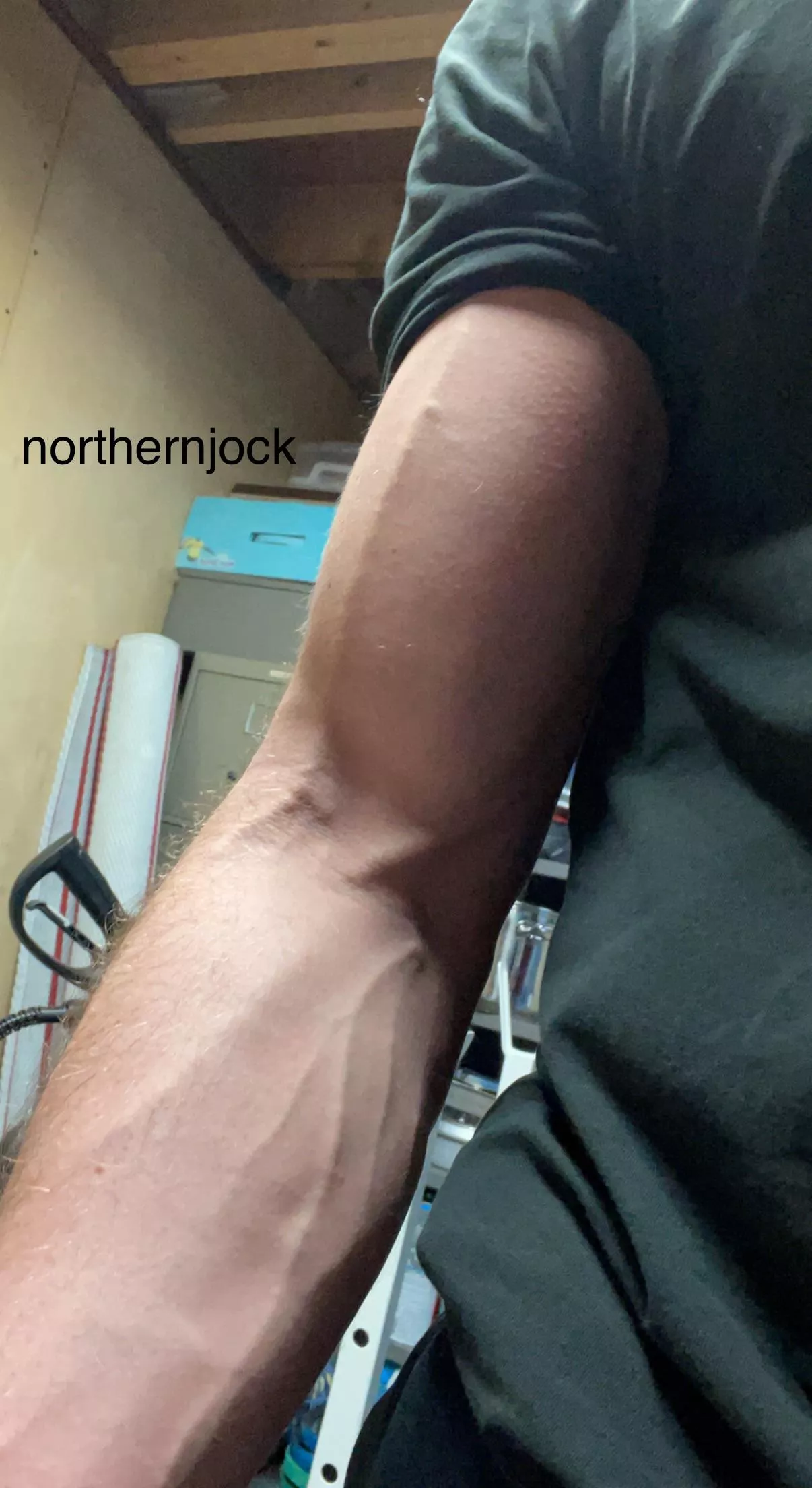 Veins for days