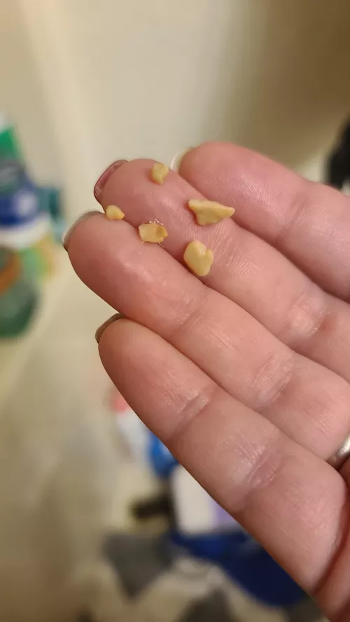 Was brushing my teeth today and sneezed these up this morning...then gaged from the smell and had to brush my teeth three times before I felt clean again.