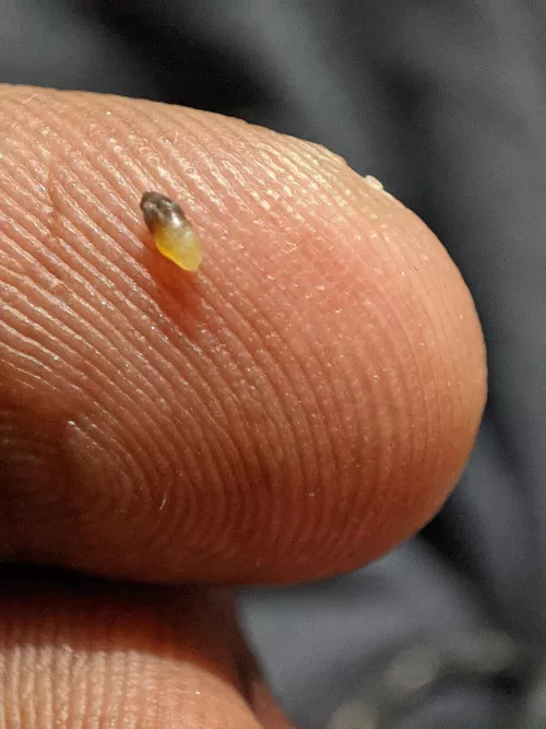 Was skinny all my life, finally gained weight after sitting at home for almost two years and was able to pop out this blackhead on my chest. I used to be so skinny that I didn't have loose skin to squeeze it out!