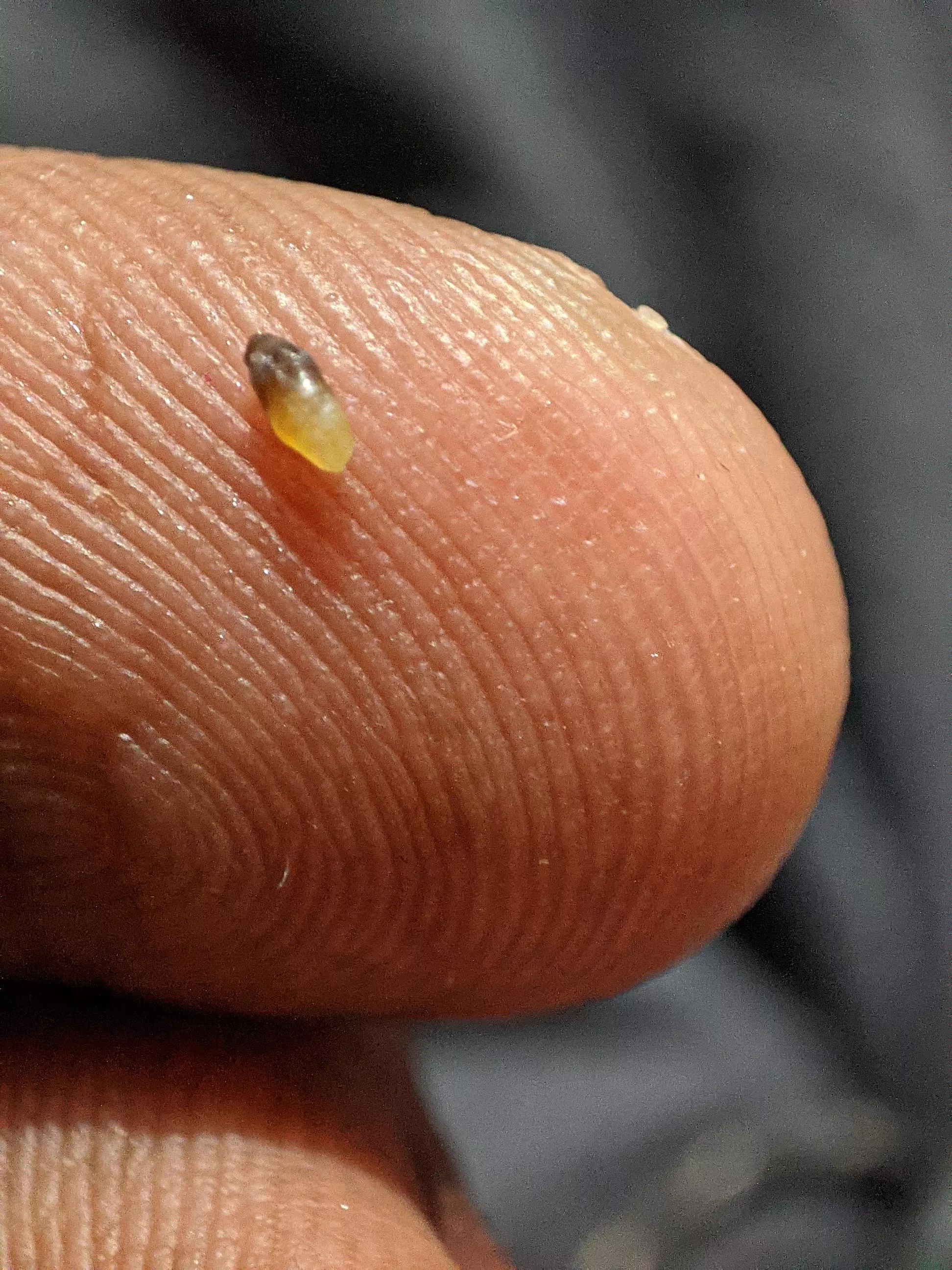 Was skinny all my life, finally gained weight after sitting at home for almost two years and was able to pop out this blackhead on my chest. I used to be so skinny that I didn't have loose skin to squeeze it out!