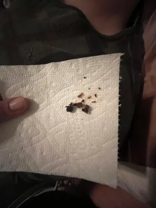 Went digging in my SO ear