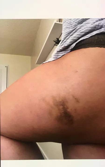 What caused this, If you had to guess? ;)