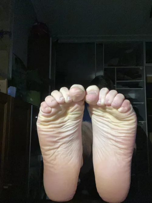 What do you think about my wrinkled soles? 🦶🏻