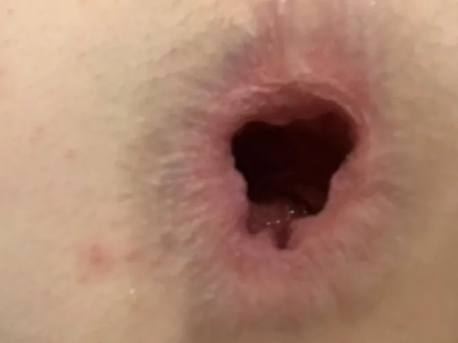 What should I do with my ass after I get a whole fist?