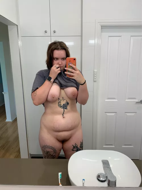 What’s your opinion on stretch marks?