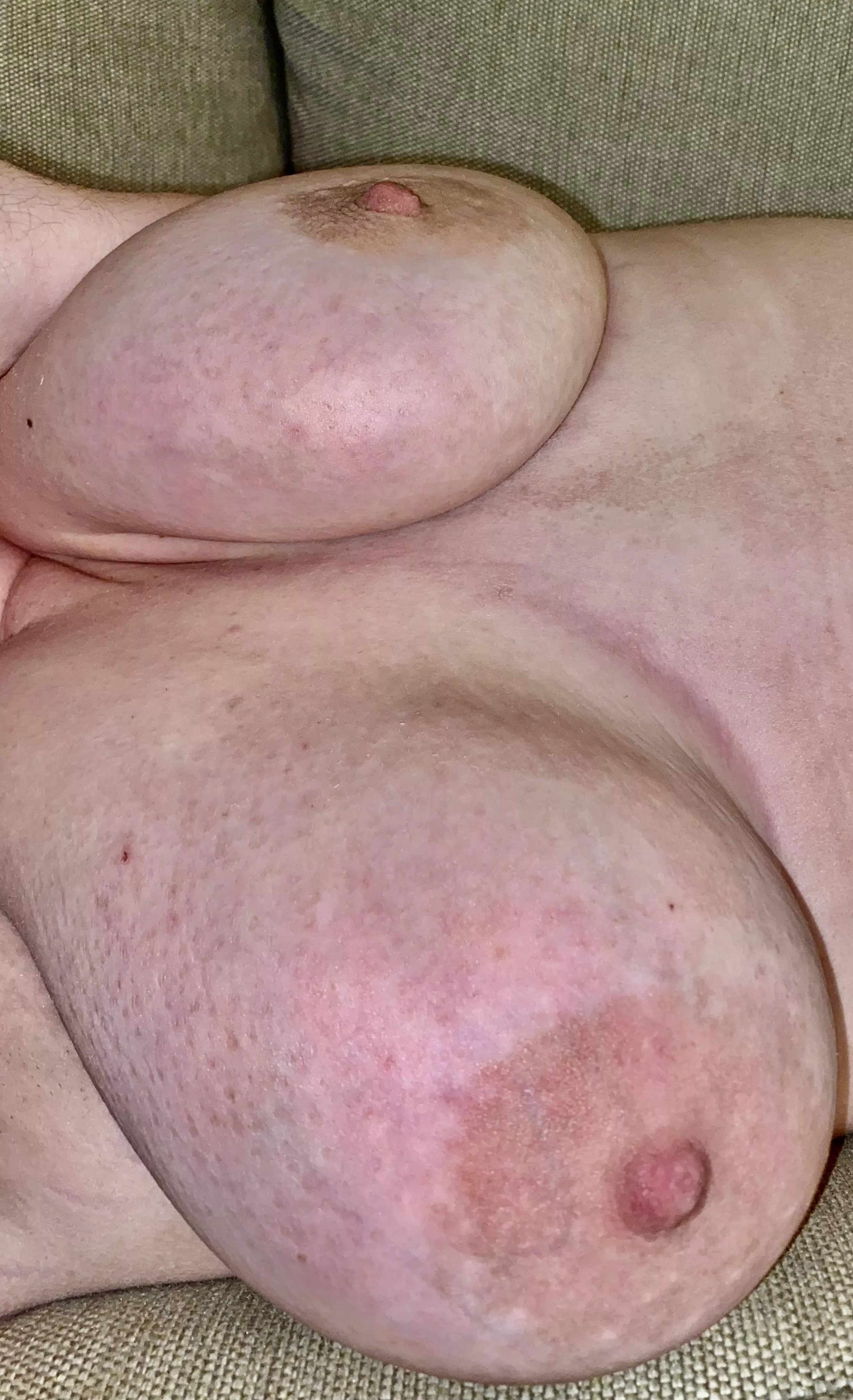 Which engorged udder are you latching onto first? Which engorged udder are you latching onto first?