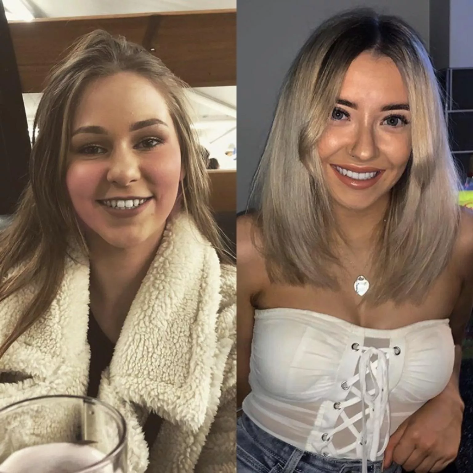 Which face are you grabbing and squashing hard? Why? Which face are you grabbing and squashing hard? Why?