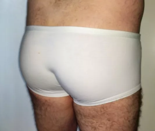White aussiebums on an Aussie