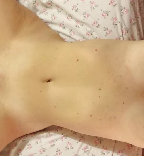 Who likes Birthmarks as much as I do?