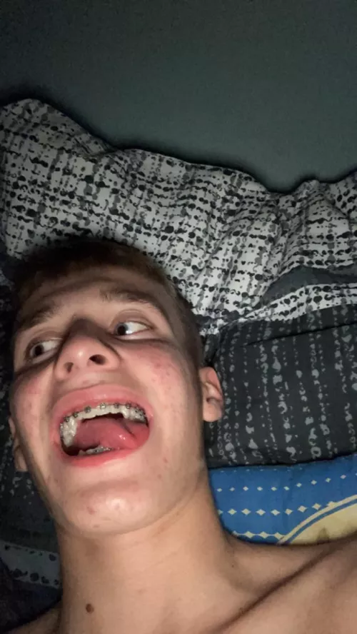 Who likes braces?π¦