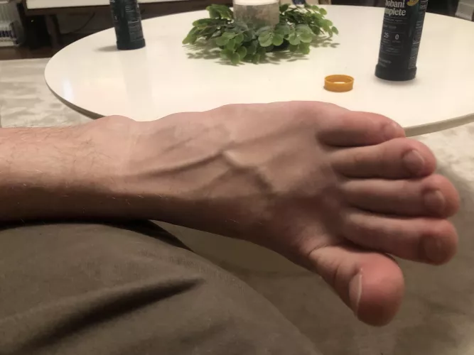 Who lives veiny feet? ππ