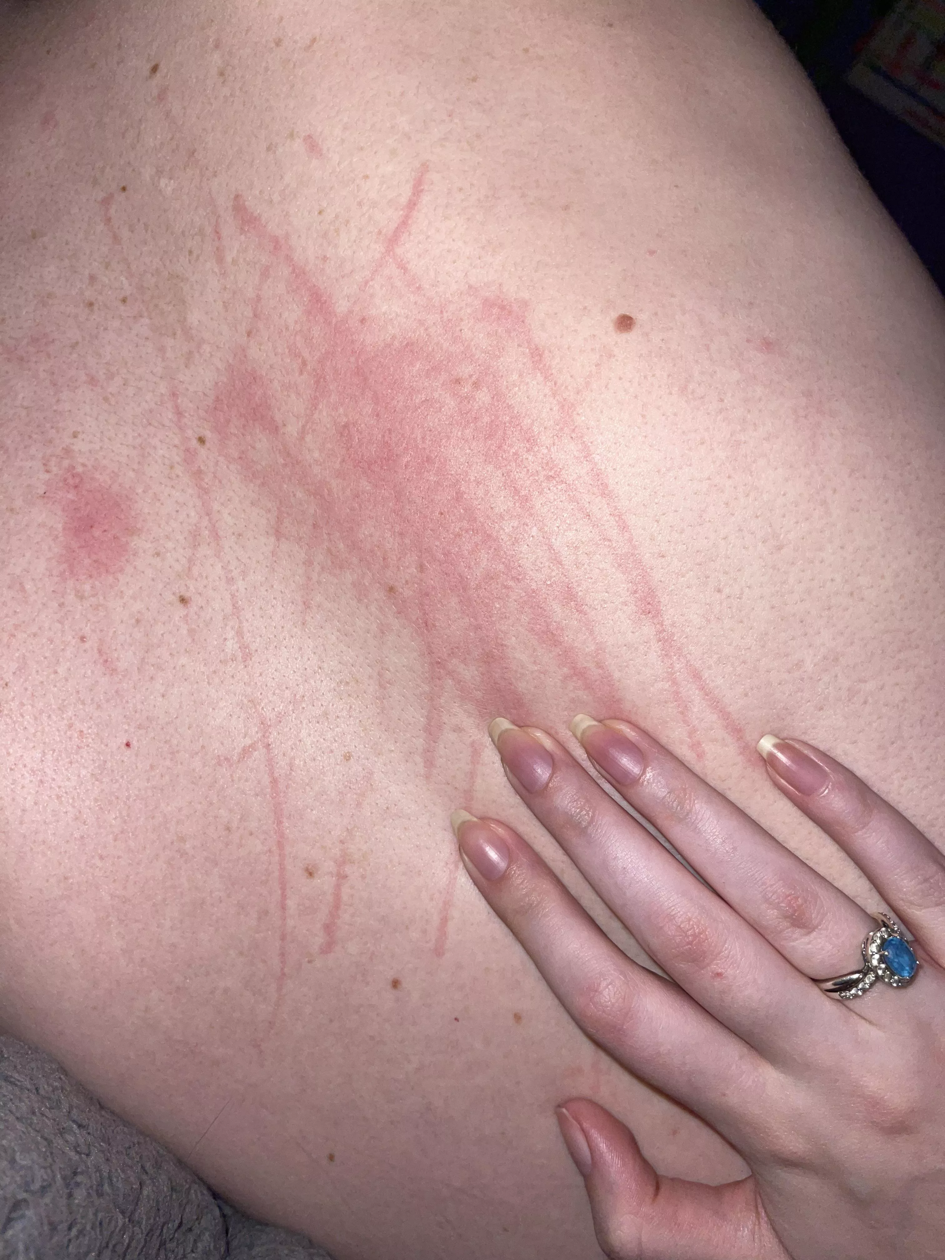 Who wants me to scratch them!! 😈💋