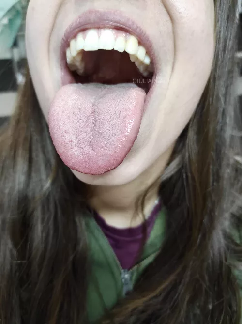 Wide open for you