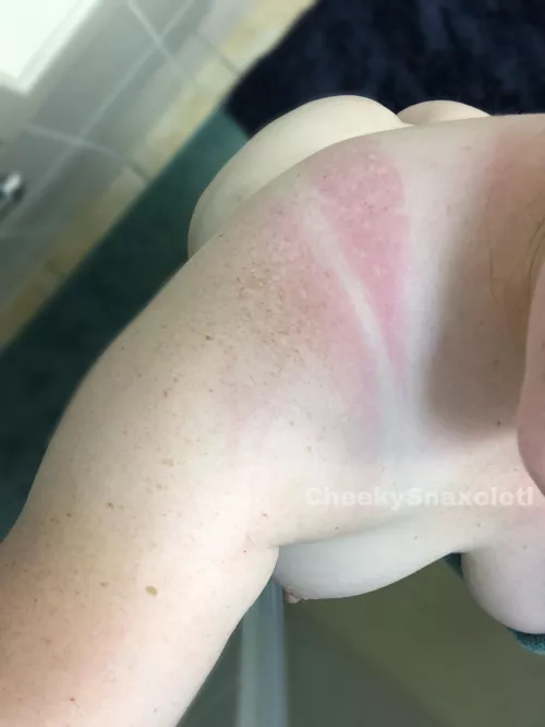 Wishing you all a year of better sunscreen appliance than my own