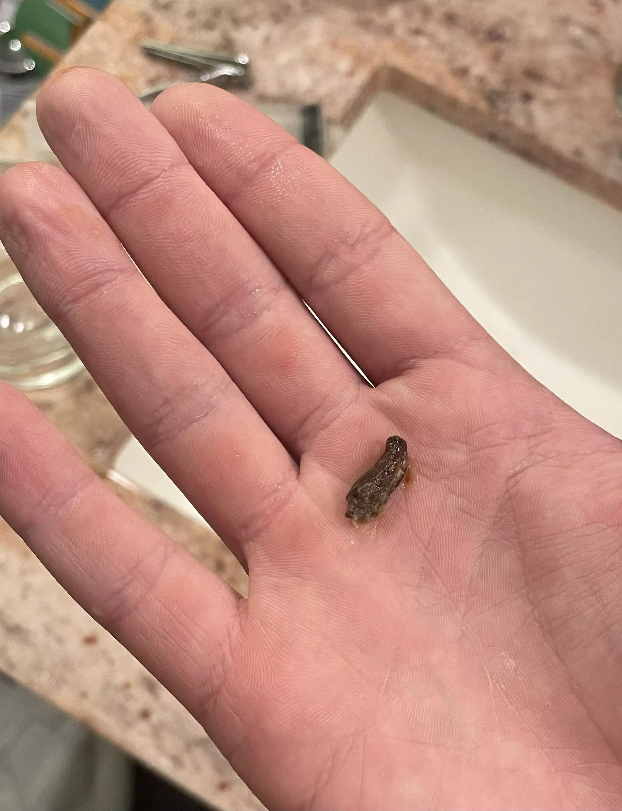 Woke up and I couldn’t hear, water irrigation got this out of my ear!