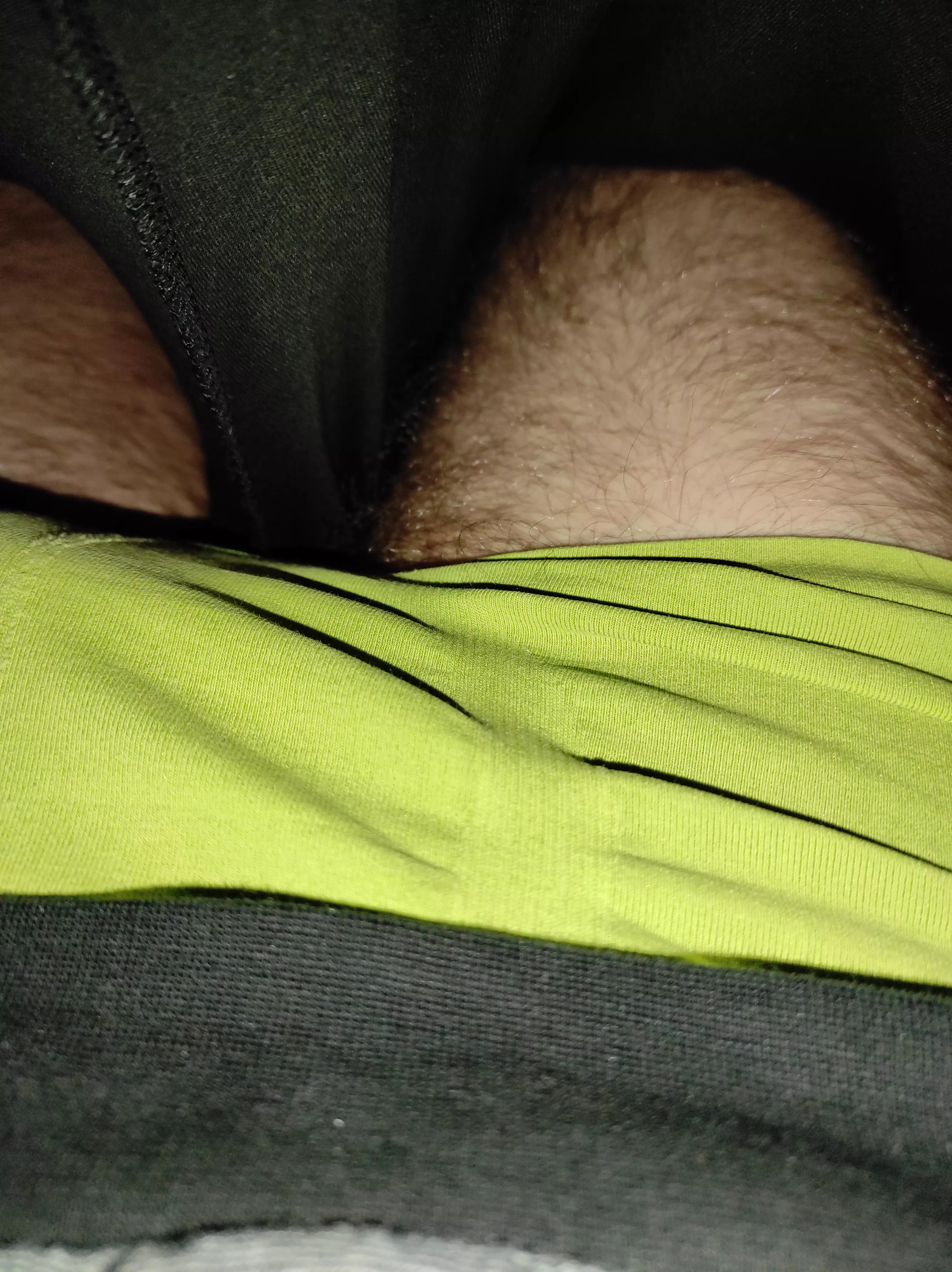 Would you have guessed that there is more hair under the green trunks? Would you have guessed that there is more hair under the green trunks?