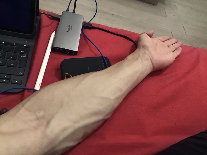 1 AM forearm🙃 Good night