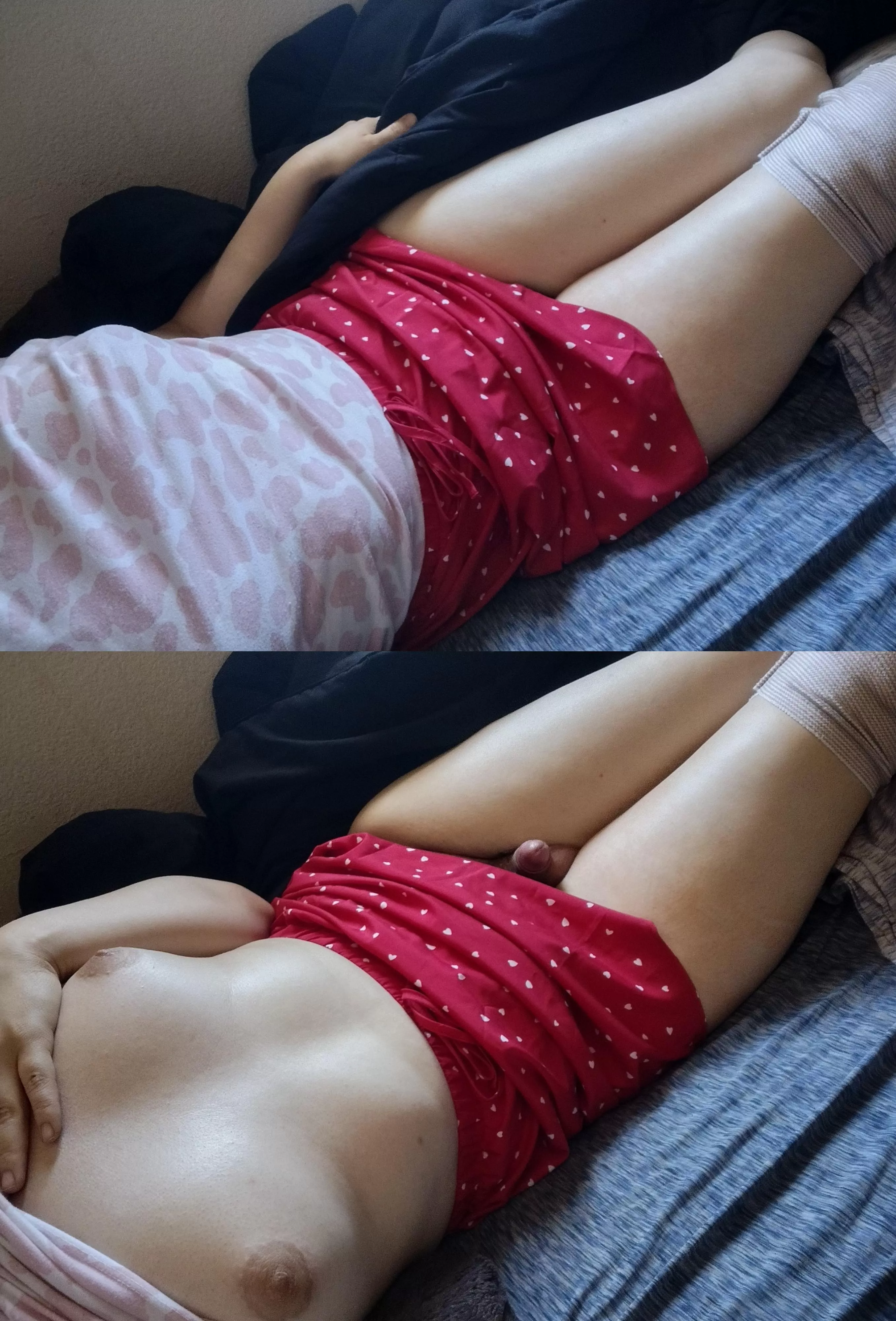 a broken leg means I can't run away (not that I was planning to anyway) 😘❤️