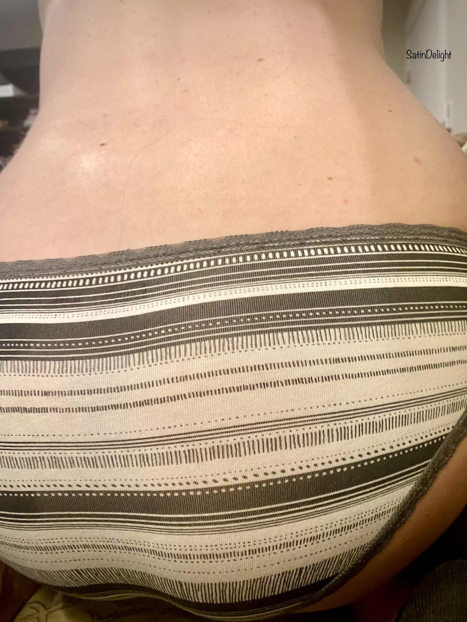 A Stripy Kind of Day 🥰