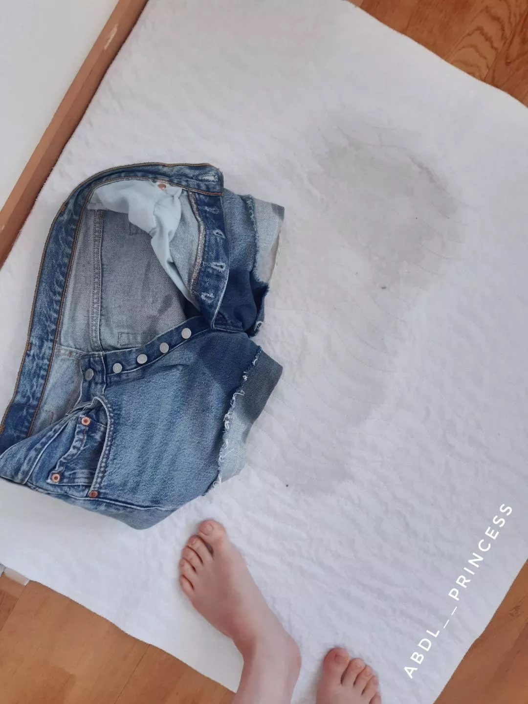 After my little 'accident' today ... (f)