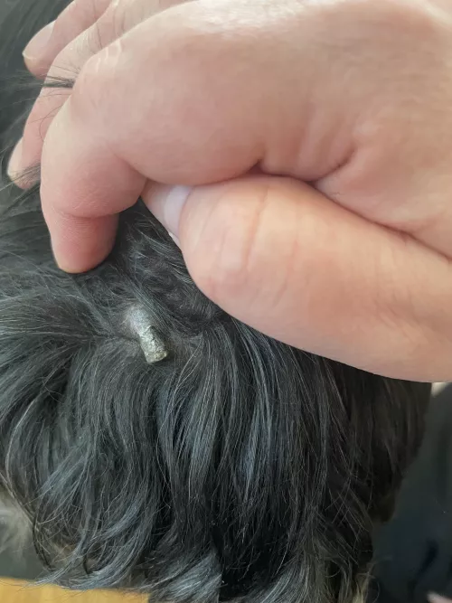 An old blackhead on old dog… popped it months ago and it must have popped out again. It’s too hard to remove on its own this time.