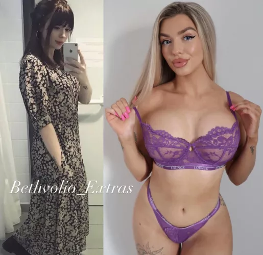 Another little update from me. Due to get more Botox and filler next week 🥰