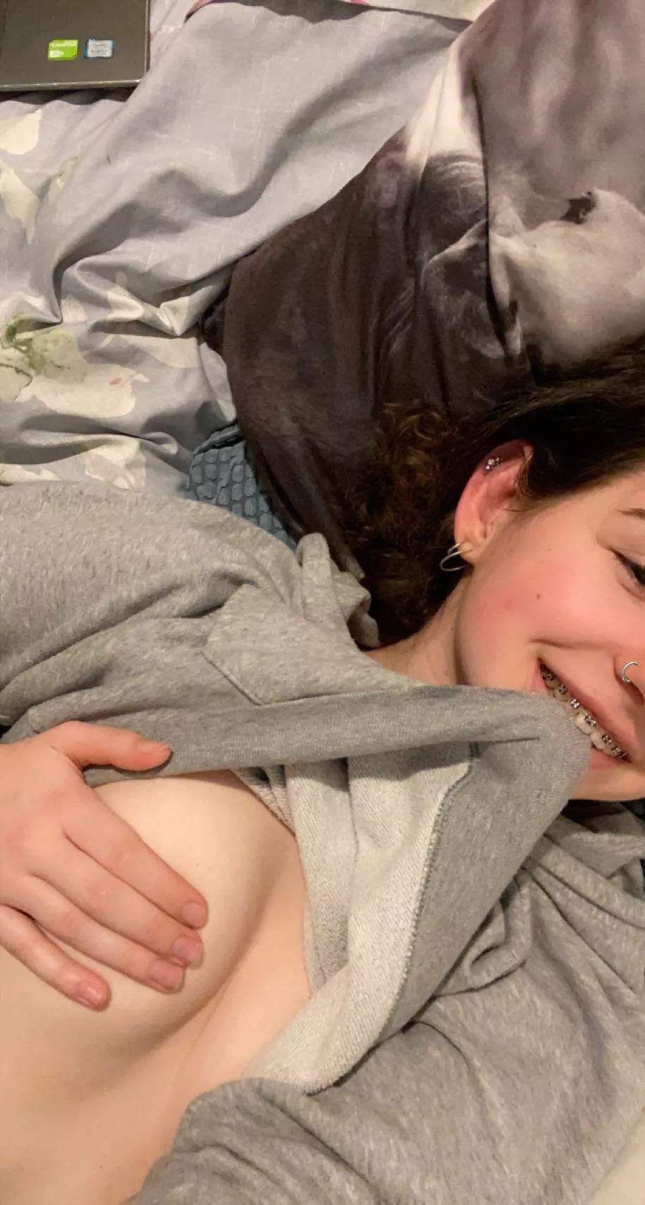 Any fans of braces here?❤️