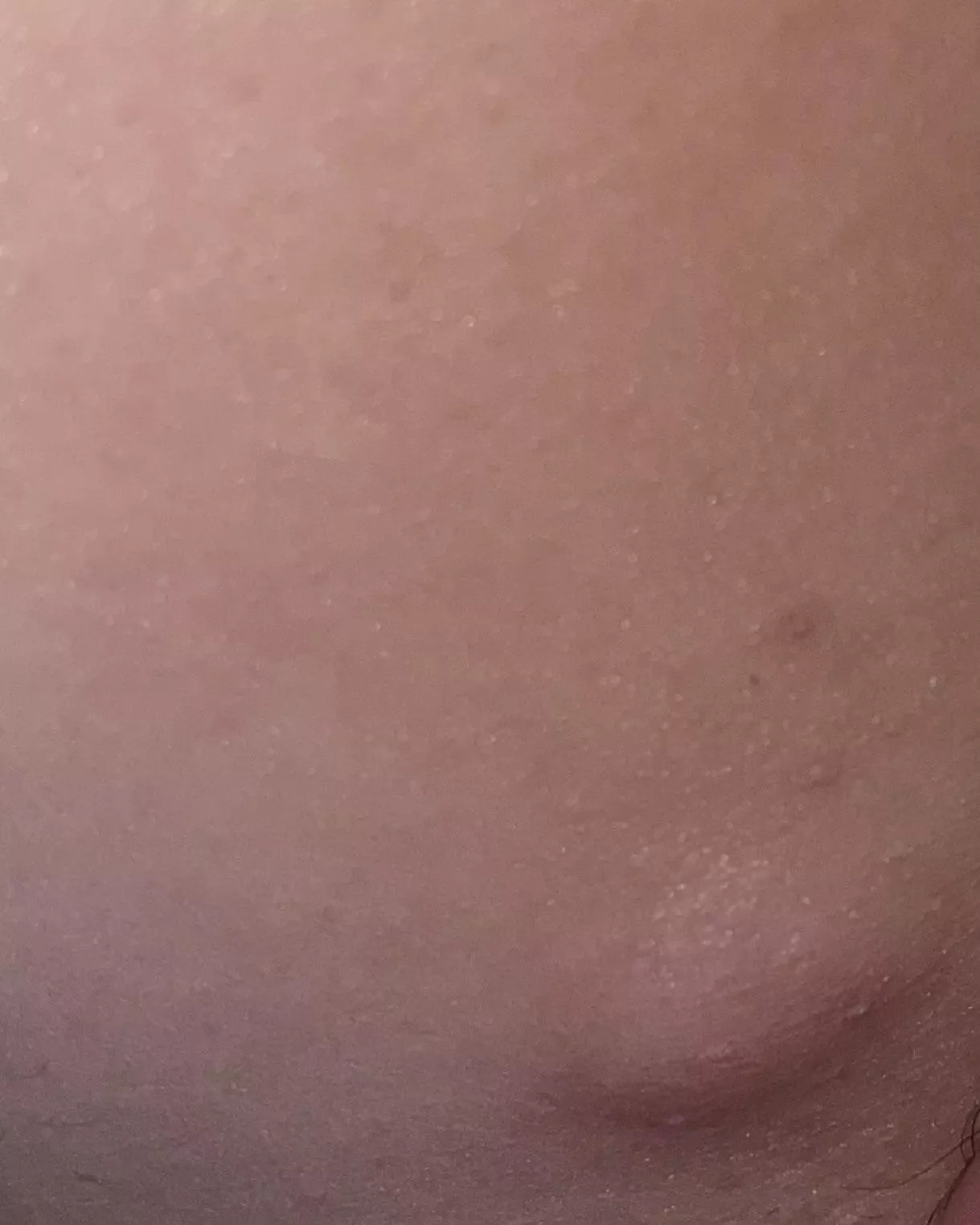 Any idea what this is? I’ve been to the doctor about two years ago and she said it felt okay. It’s got bigger since and hurts more. It’s on the inner side of my groin/leg.