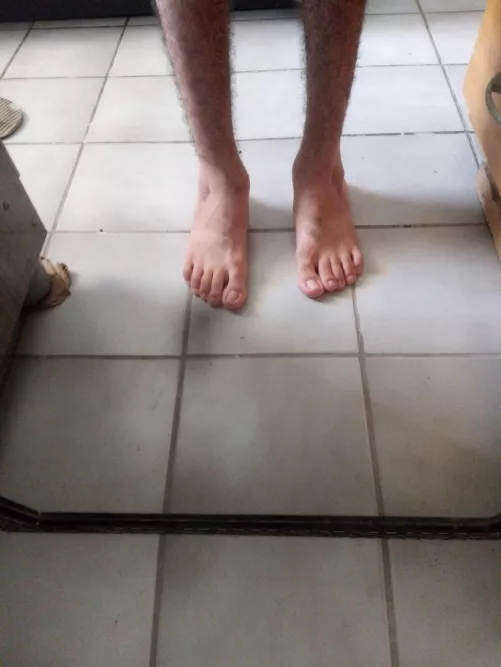 Are there people who have fetish for deformed feet? So I could make money off the part of my body i hate the most 🤷
