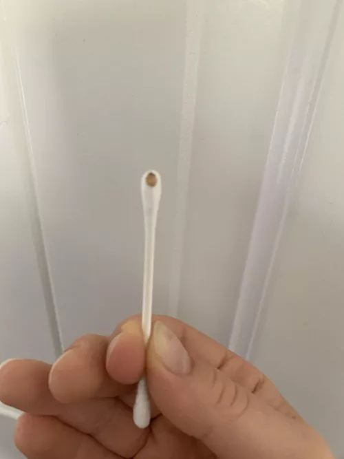 Bartholin’s Cyst...I can finally sit again!