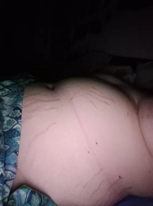 bloated + stretch marks appreciation