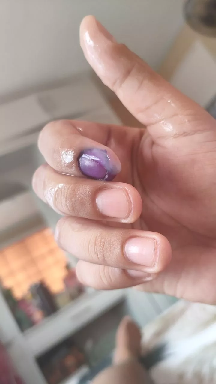 Bu(m)oto na ba lahat