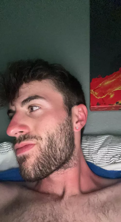 Burnt is an understatement š