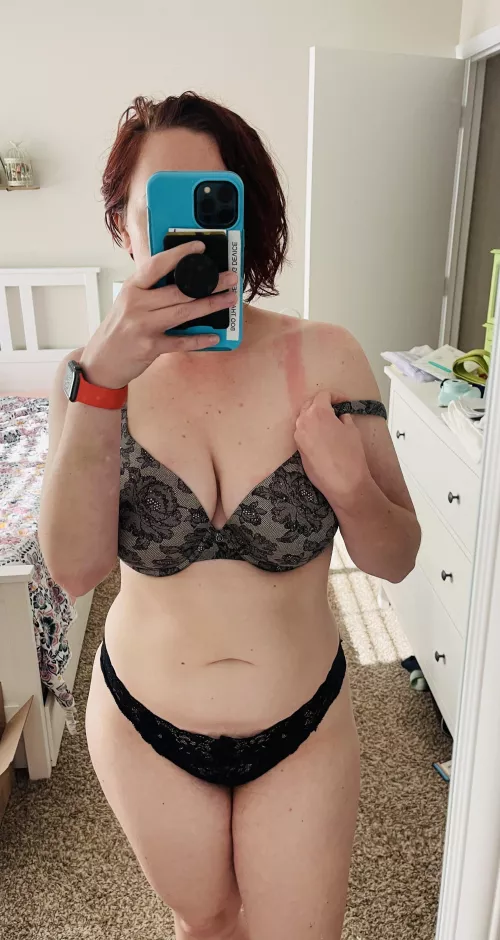 Could use a little help rubbing aloe on my sunburn…