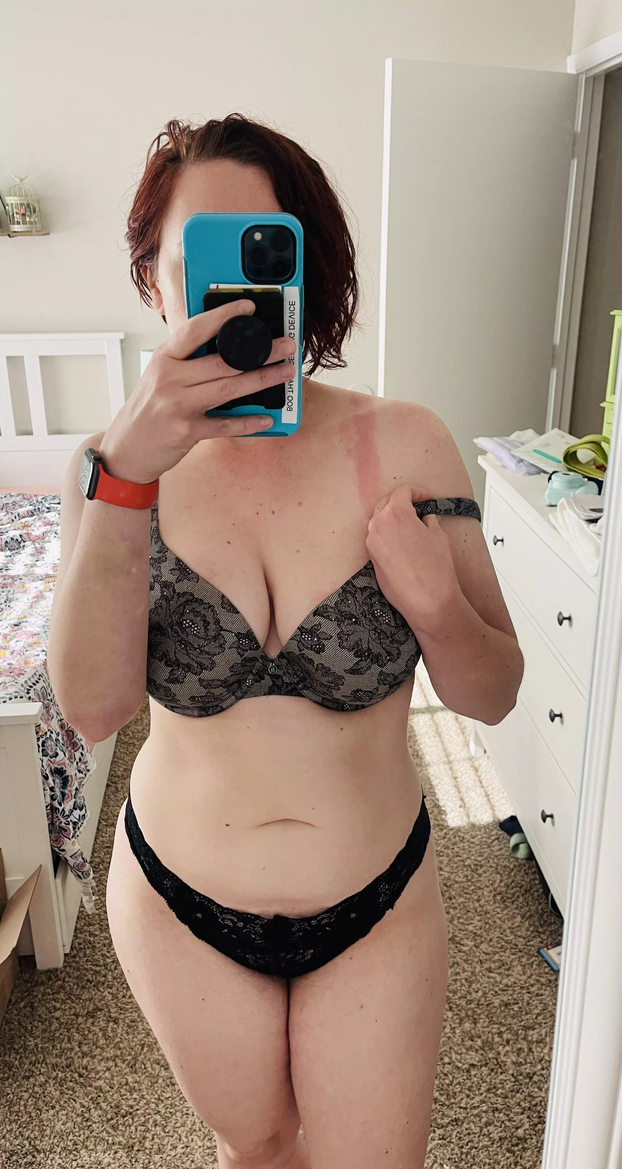 Could use a little help rubbing aloe on my sunburn…