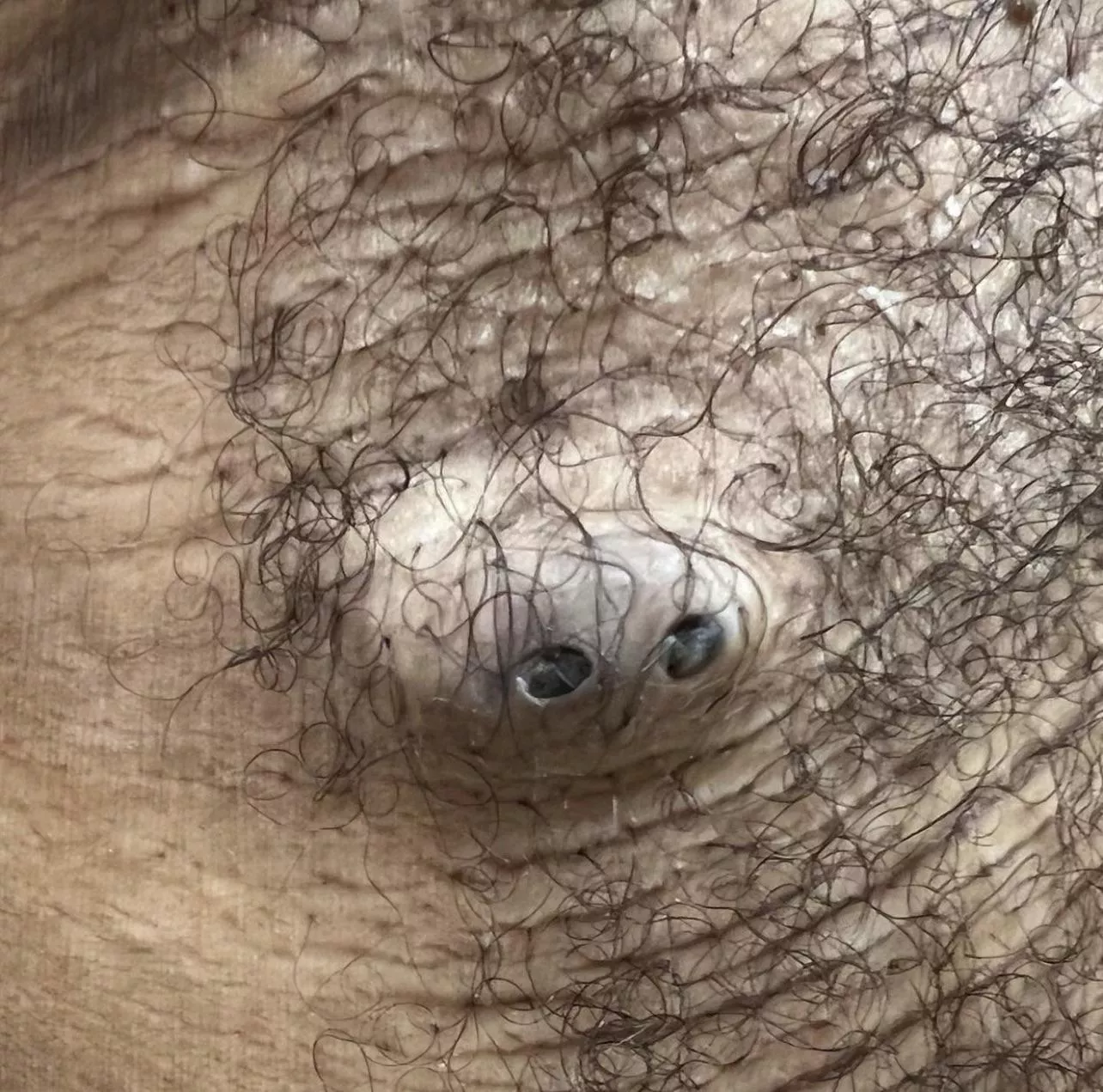 DPOW picture from Dr Sandra Lee on Instagram