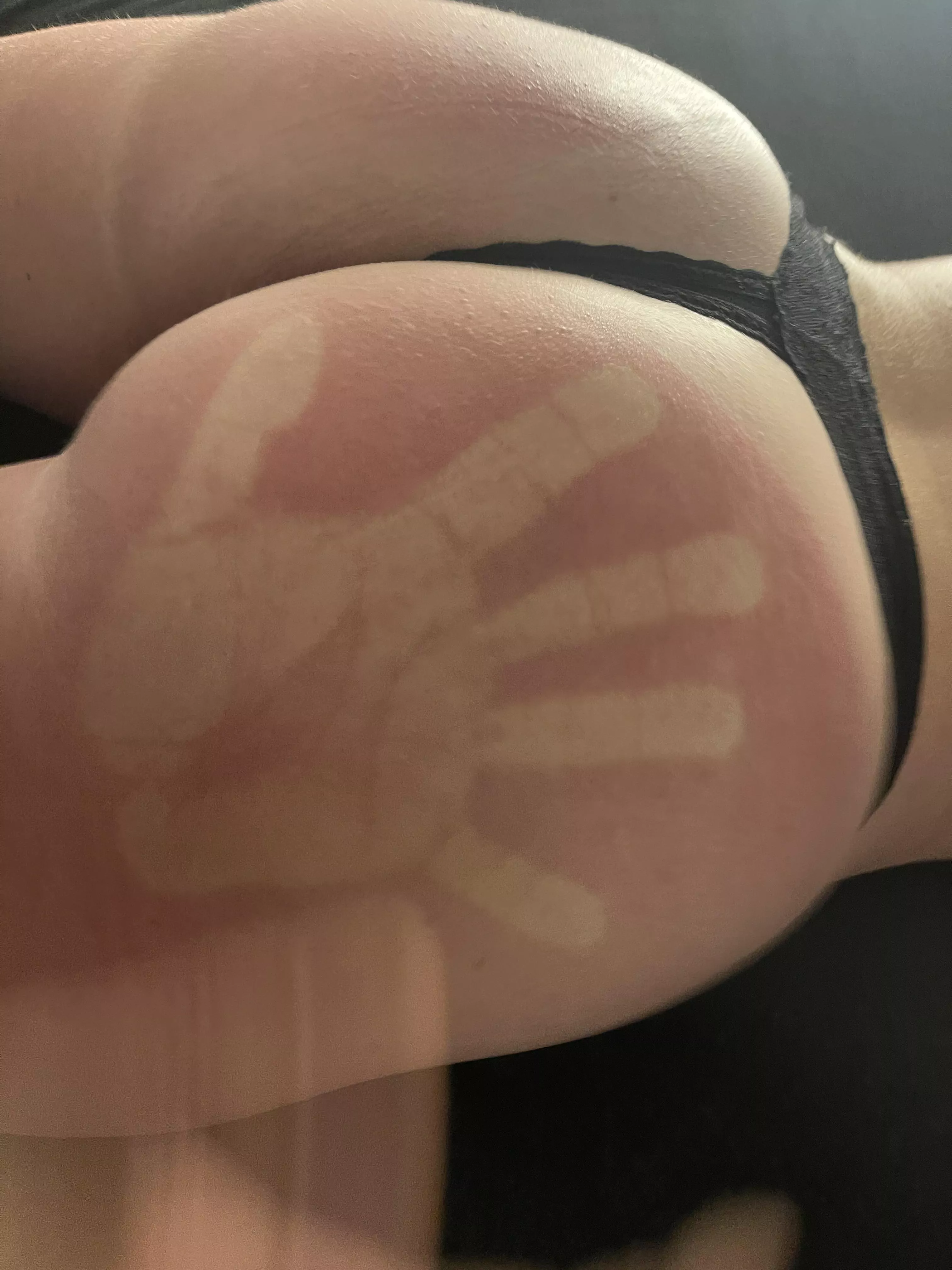 (F) I prefer when my ass is red with a handprint…. Not the other way around 🙄